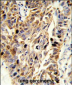 EFEMP1 Antibody (N-term)